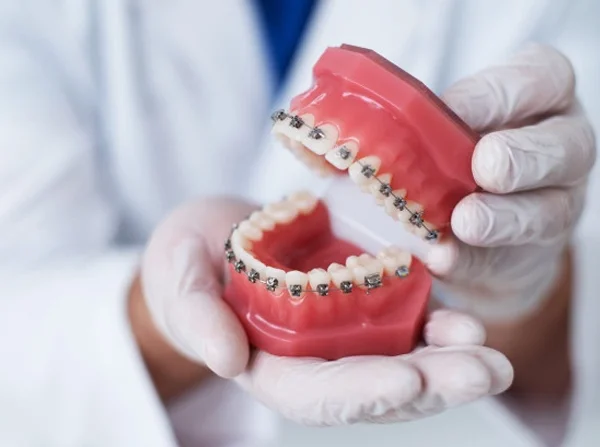 Braces